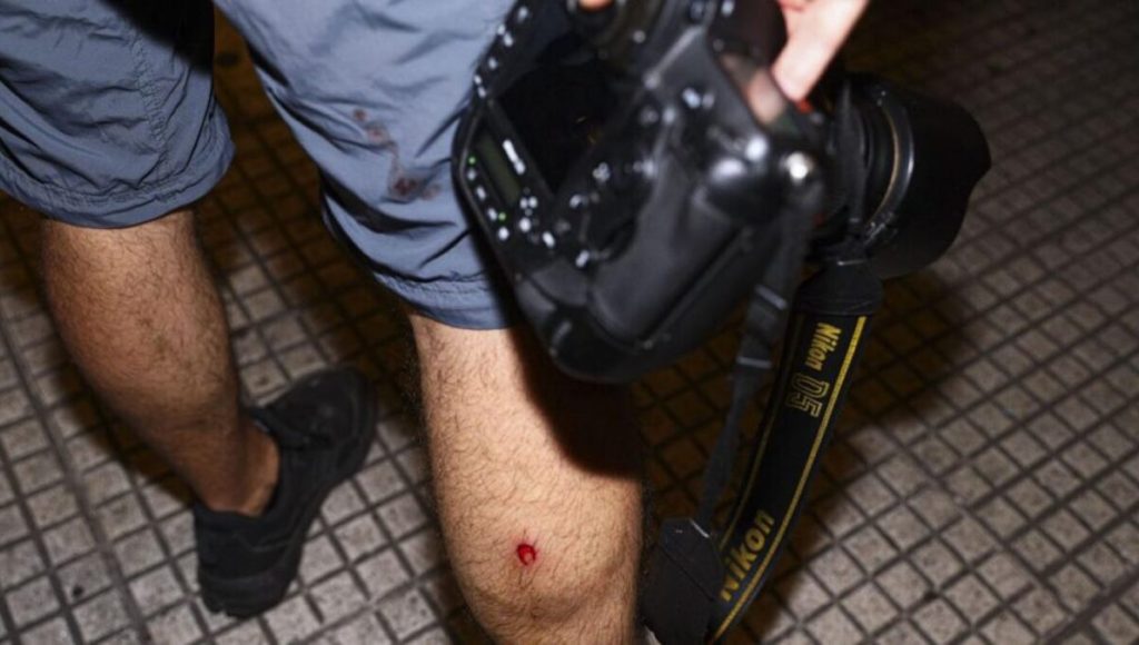 periodistas heridos en el Congreso, Ley Ómnibus